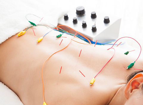 電気鍼（パルス鍼）